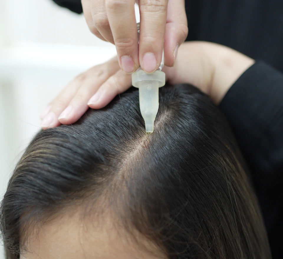 Scalp Specialist Treatment 5